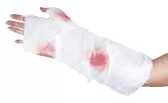 prevezovanje poškodovane roke s krvjo